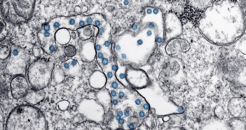 A Beginner’s Guide to Understanding Gut Health